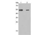 C1 inhibitor Antibody in Western Blot (WB)