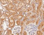 HPD Antibody in Immunohistochemistry (Paraffin) (IHC (P))