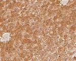 HPD Antibody in Immunohistochemistry (Paraffin) (IHC (P))