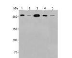 SPTBN1 Antibody in Western Blot (WB)