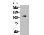 GRIK4 Antibody in Western Blot (WB)