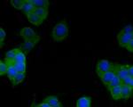 SAPAP1 Antibody in Immunocytochemistry (ICC/IF)