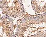 SAPAP1 Antibody in Immunohistochemistry (Paraffin) (IHC (P))