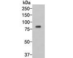 SAPAP1 Antibody in Western Blot (WB)