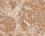 PDCD6 Antibody in Immunohistochemistry (Paraffin) (IHC (P))