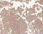 PDCD6 Antibody in Immunohistochemistry (Paraffin) (IHC (P))