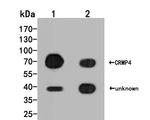 DPYSL3 Antibody in Western Blot (WB)