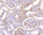 GFPT1 Antibody in Immunohistochemistry (Paraffin) (IHC (P))