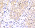 GFPT1 Antibody in Immunohistochemistry (Paraffin) (IHC (P))