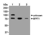 GFPT1 Antibody in Western Blot (WB)