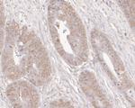 ADK Antibody in Immunohistochemistry (Paraffin) (IHC (P))