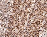 ADK Antibody in Immunohistochemistry (Paraffin) (IHC (P))