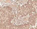 PHLDA1 Antibody in Immunohistochemistry (Paraffin) (IHC (P))