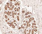 PHLDA1 Antibody in Immunohistochemistry (Paraffin) (IHC (P))