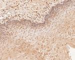 PHLDA1 Antibody in Immunohistochemistry (Paraffin) (IHC (P))