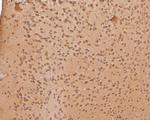 PHLDA1 Antibody in Immunohistochemistry (Paraffin) (IHC (P))