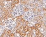 GAMT Antibody in Immunohistochemistry (Paraffin) (IHC (P))