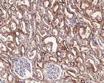 Syk Antibody in Immunohistochemistry (Paraffin) (IHC (P))