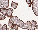 HSD3B1 Antibody in Immunohistochemistry (Paraffin) (IHC (P))