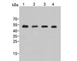 ADSL Antibody in Western Blot (WB)