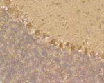 JNK2 Antibody in Immunohistochemistry (Paraffin) (IHC (P))