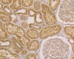 JNK2 Antibody in Immunohistochemistry (Paraffin) (IHC (P))