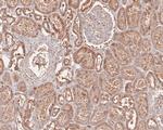 Phospho-AKT2 (Ser474) Antibody in Immunohistochemistry (Paraffin) (IHC (P))