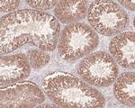 Phospho-AKT2 (Ser474) Antibody in Immunohistochemistry (Paraffin) (IHC (P))