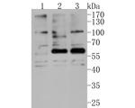 Phospho-AKT2 (Ser474) Antibody in Western Blot (WB)