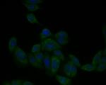 PAI1 Antibody in Immunocytochemistry (ICC/IF)