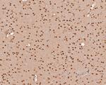 THOC5 Antibody in Immunohistochemistry (Paraffin) (IHC (P))