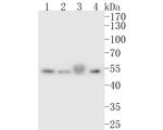 ONECUT3 Antibody in Western Blot (WB)