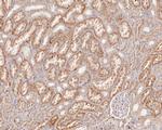 beta Galactosidase Antibody in Immunohistochemistry (Paraffin) (IHC (P))