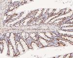 XPA Antibody in Immunohistochemistry (Paraffin) (IHC (P))