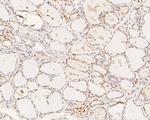 XPA Antibody in Immunohistochemistry (Paraffin) (IHC (P))