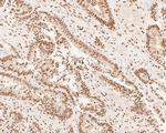 XPA Antibody in Immunohistochemistry (Paraffin) (IHC (P))