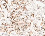 XPA Antibody in Immunohistochemistry (Paraffin) (IHC (P))