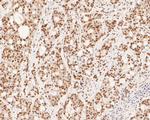 XPA Antibody in Immunohistochemistry (Paraffin) (IHC (P))