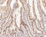 XPA Antibody in Immunohistochemistry (Paraffin) (IHC (P))