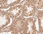 XPA Antibody in Immunohistochemistry (Paraffin) (IHC (P))