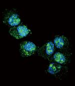 PGP9.5 Antibody in Immunocytochemistry (ICC/IF)