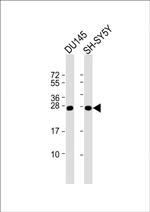 PGP9.5 Antibody in Western Blot (WB)