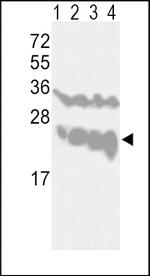 PGP9.5 Antibody in Western Blot (WB)