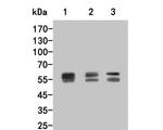 Lyn Antibody in Western Blot (WB)