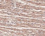 VLDLR Antibody in Immunohistochemistry (Paraffin) (IHC (P))