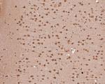 ZIC2 Antibody in Immunohistochemistry (Paraffin) (IHC (P))