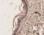 ZIC2 Antibody in Immunohistochemistry (Paraffin) (IHC (P))