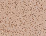 ZIC2 Antibody in Immunohistochemistry (Paraffin) (IHC (P))