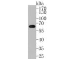 CYP24A1 Antibody in Western Blot (WB)