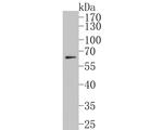 CYP24A1 Antibody in Western Blot (WB)